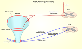 Transobturator Slings: End of the Road