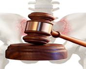 gavel in front of pelvic illustration - tvm
