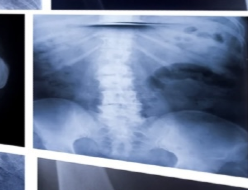 Polypropylene Mid-Urethral Slings: “God Awful Data”, Serious Complications Rate Revealed